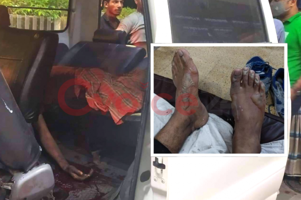 সীতাকুণ্ডে বিস্ফোরণে নিহত ৪, আহত দেড় শতাধিক