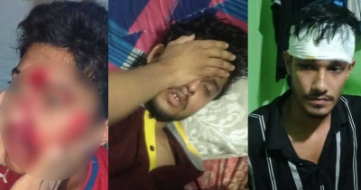 কাপ্তাই পলিটেকনিকে দুই পক্ষের সংঘর্ষে আহত ৯ কাপ্তাই পলিটেকনিকে দুই পক্ষের সংঘর্ষে আহত ৯