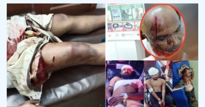 সাতকানিয়ায় বিএনপি`র দু`গ্রুপের দফায় দফায় সংঘর্ষ, আহত ৫