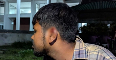 চবিতে ছাত্রদলের বিরোধের জেরে ছাত্রশক্তির নেতাকে মারধর