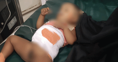 রোহিঙ্গা ক্যাম্পে বাবার অস্ত্রের গুলিতে শিশু আহত রোহিঙ্গা ক্যাম্পে বাবার অস্ত্রের গুলিতে শিশু আহত